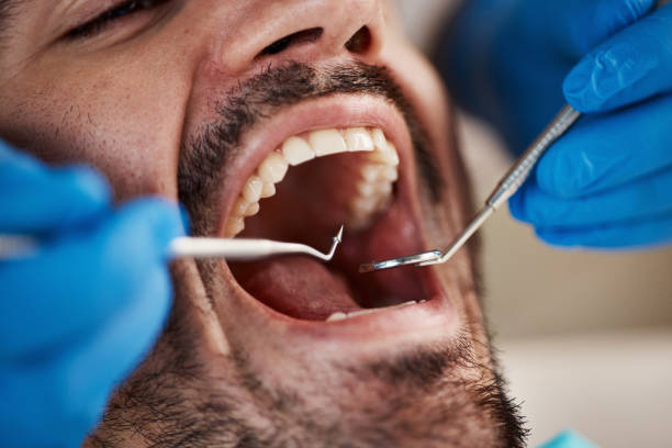 Best Knocked-Out Tooth Emergency  in Millbury, OH